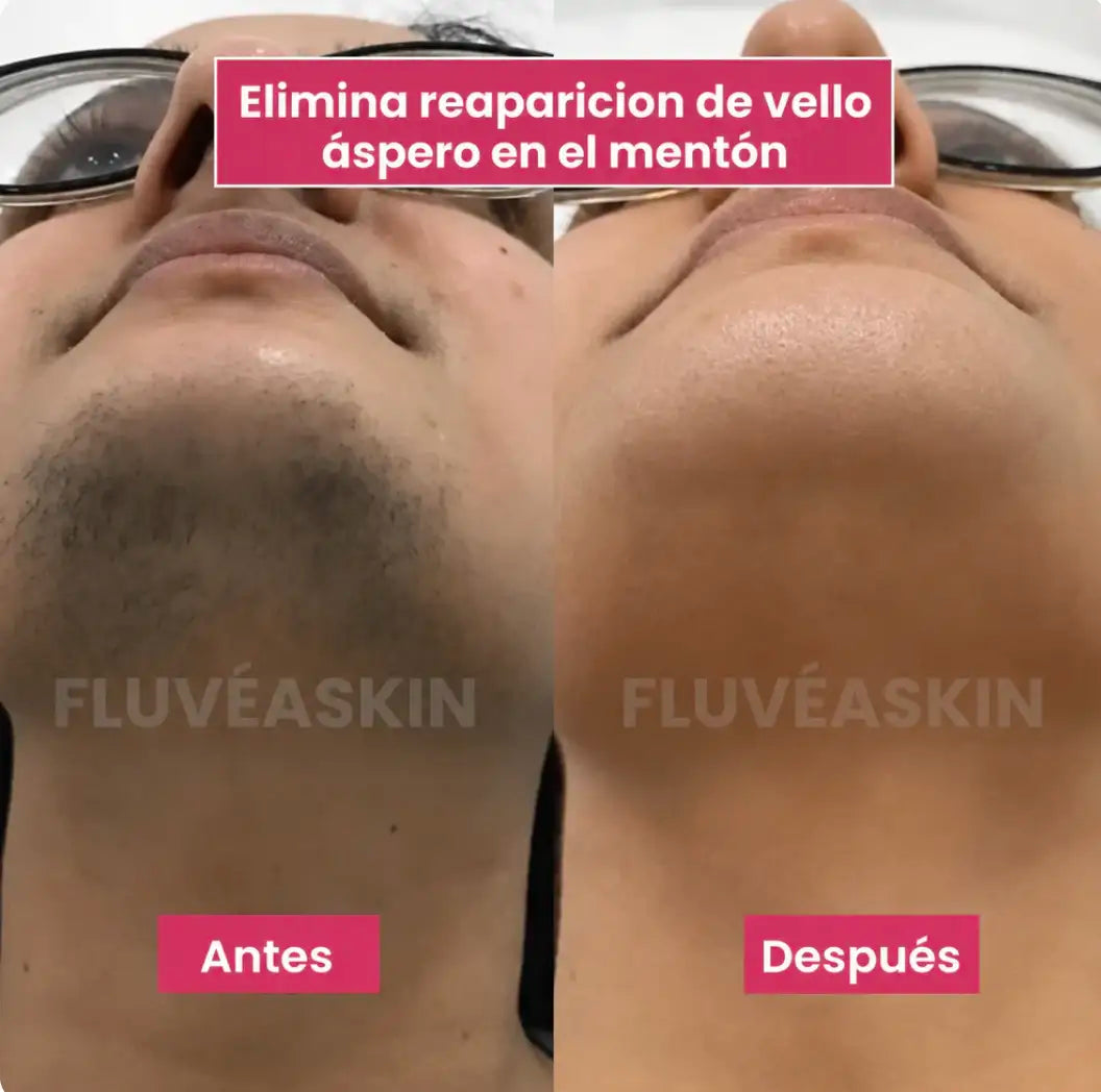 Aceite para Depilación Definitiva